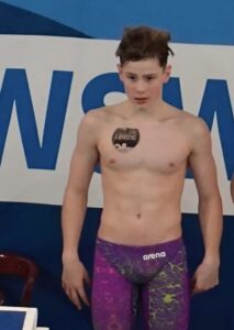 Birgel, Mick Günter